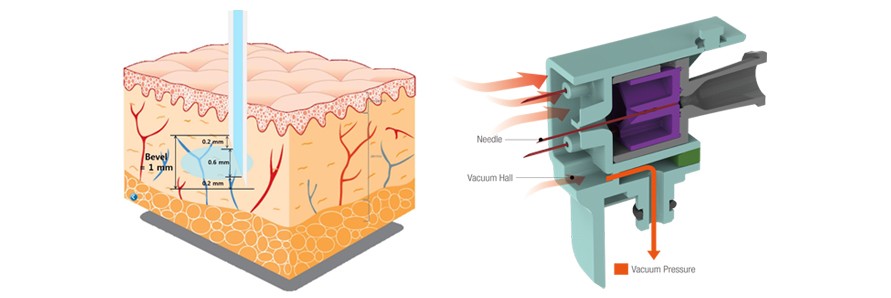 Vital-injector-2-technology (1)